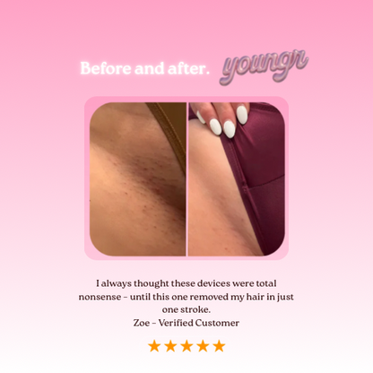 YOUNGR™ Bikini Shaver V3