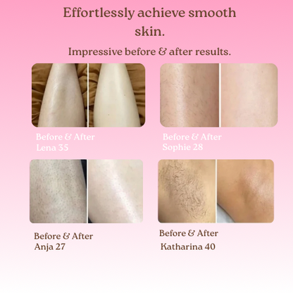 YOUNGR™ Bikini Shaver V3